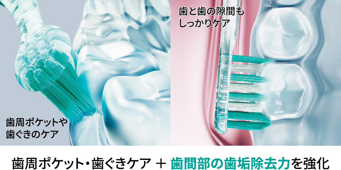 画像：歯周ポケットやぐきのケア、歯と歯の隙間もしっかりケア、歯周ポケット・歯ぐきケア ＋ 歯間部の歯垢除去力を強化