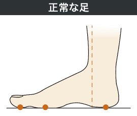 正常な足