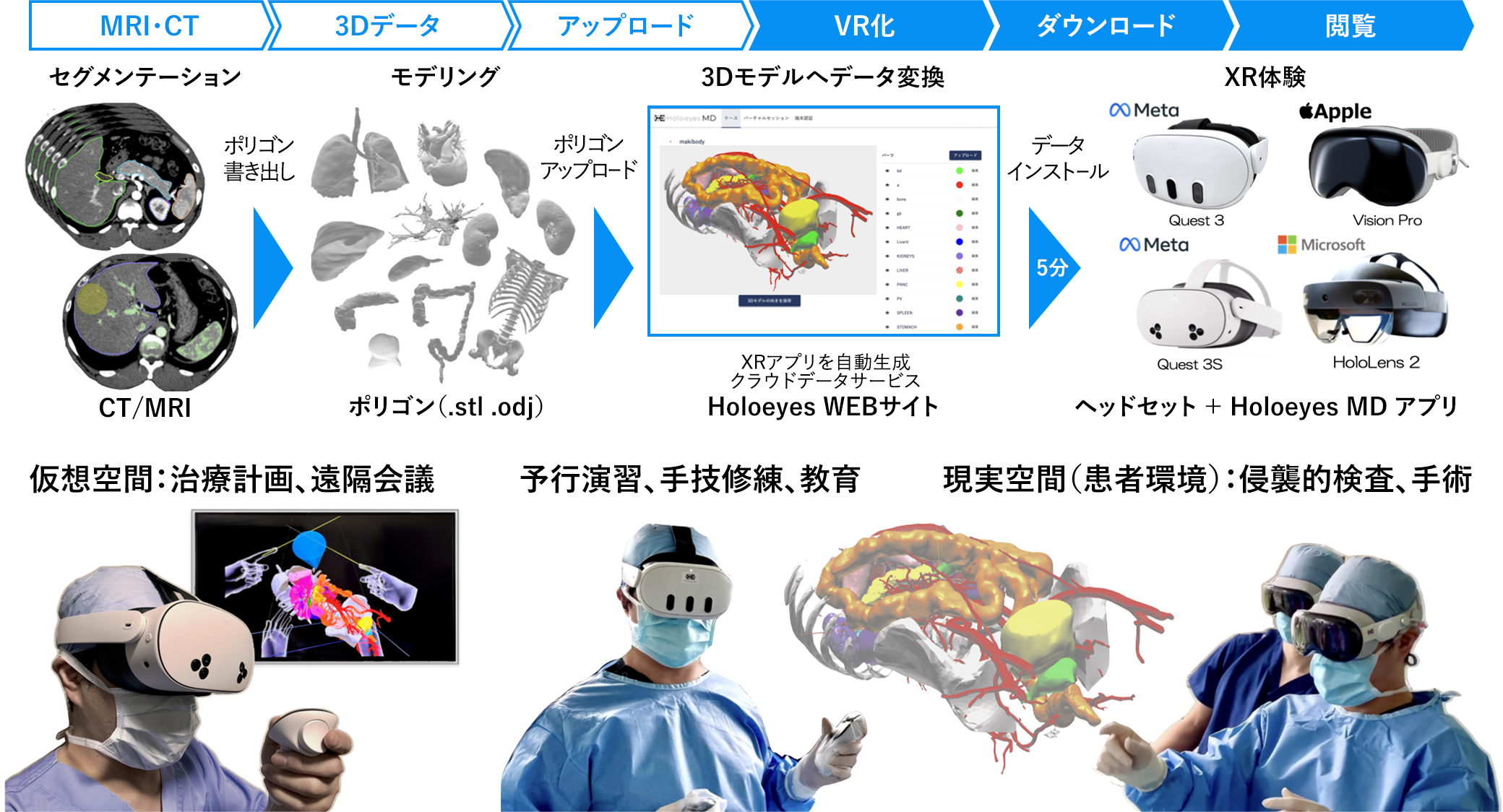 CT・MRIで撮影された医用画像を自動でVR化し、解剖構造を空間的に再現し臨床活用するクラウドサービスの全体像