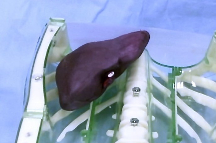 3D臓器が映し出されている画像